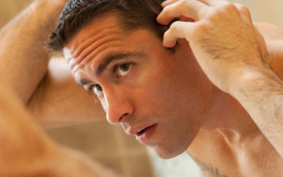 Vypadávání vlasů u mužů – Jaká jsou účinná řešení?