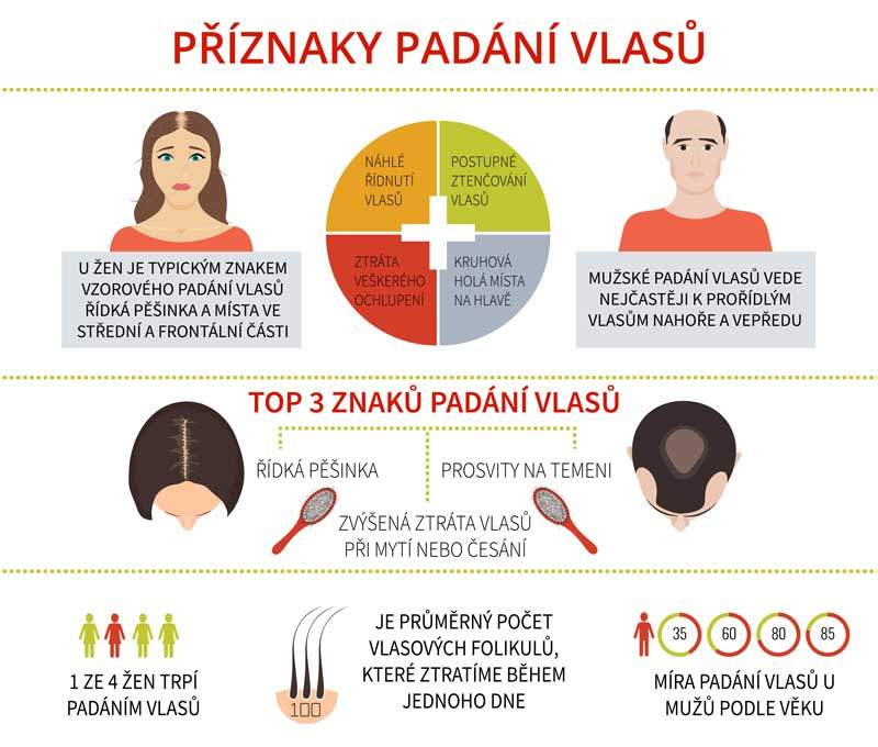 příznaky padání vlasů u mužů a žen infografika
