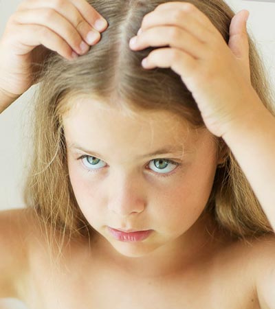 vypadávání vlasů u detí