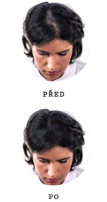 Nanogen pro ženy s řídkými vlasy před a po