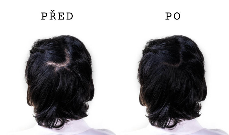 co dokáže zahušťovač řídkých vlasů žena černé rovné vlasy